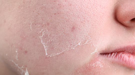 What Your Dermatologist Won't Tell You About Retinol